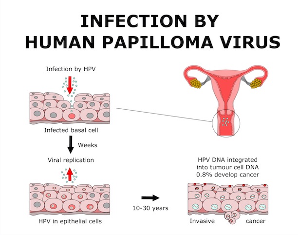 Virus papiloma humanos oposición matronas