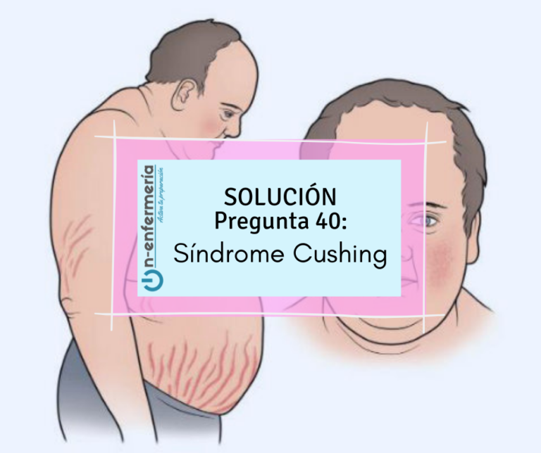 OPE 2020 Sindrome de-cushng-on-enfermeria