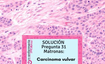 carcinoma in situ vulvar-simulacros matronas-patología vulvar