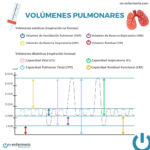 Infografía Volúmenes pulmonares - Aparato respiratorio