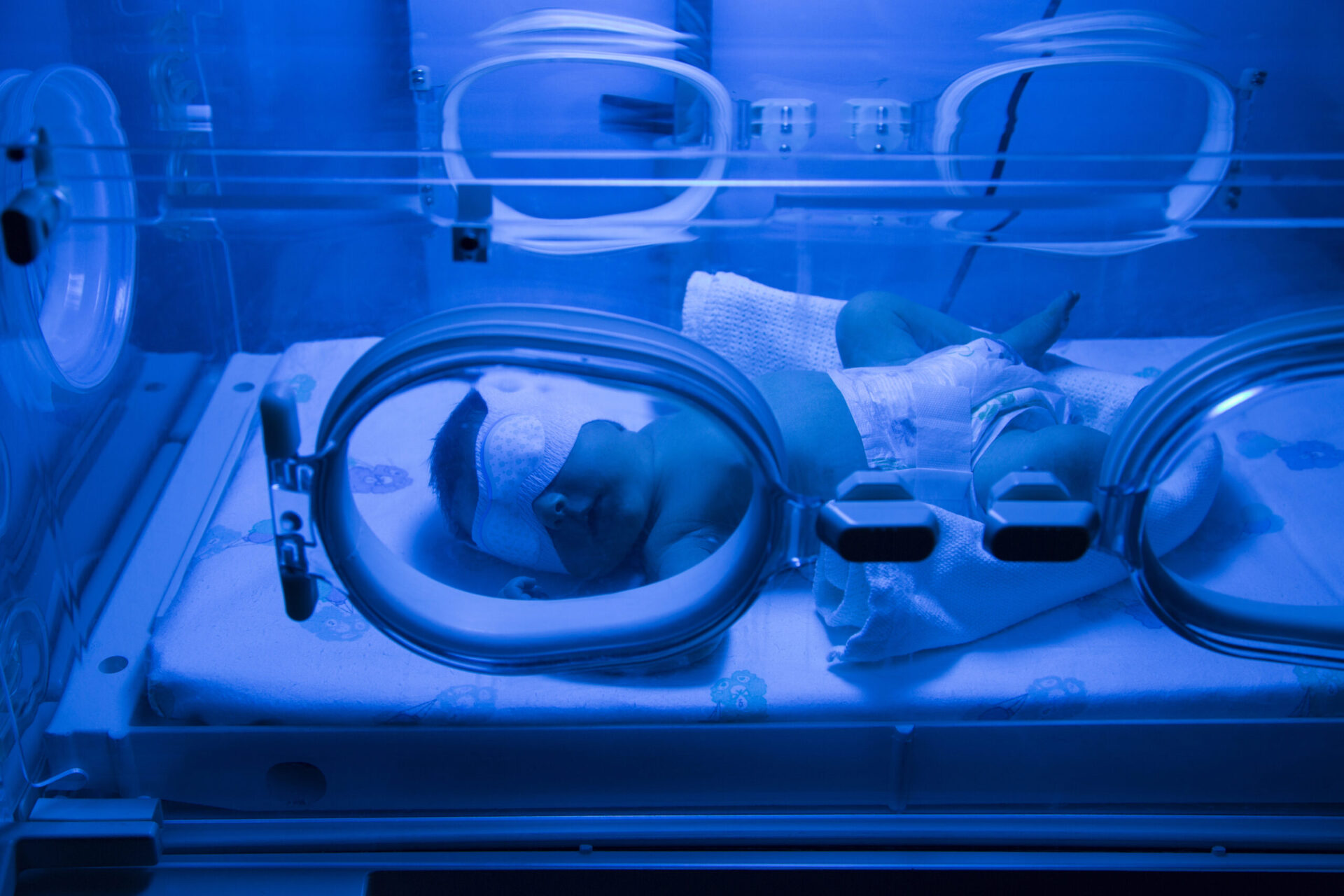 Recién nacido incubadora fototerapia