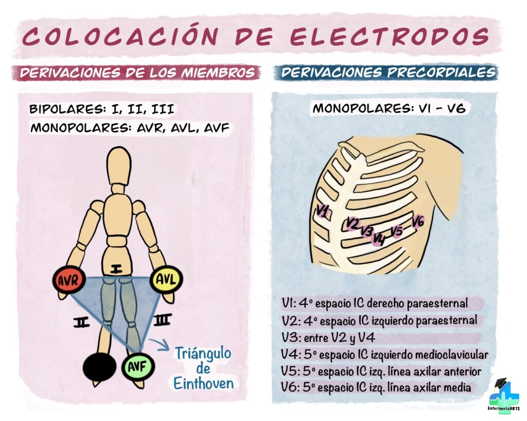 Colocaci n De Electrodos 12 Derivaciones ERNKC Colocaci n De Electrodos 12 Derivaciones ERNKC